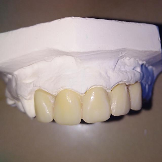 prótesis dental turnos