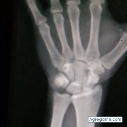 yasserqo chico soltero en El Bordo