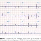 Lolololololololol. Lolololololol.