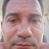Raimer Carracedo Martínez
