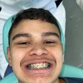 Acuaman10